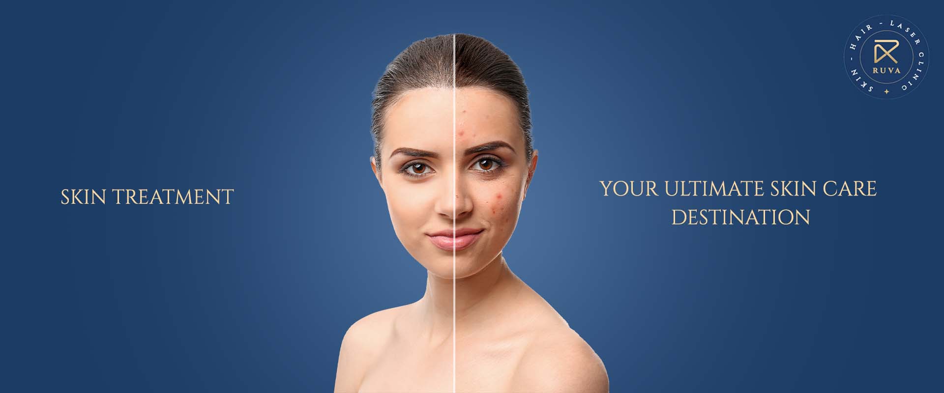 Best Skin Clinic in Choolaimedu