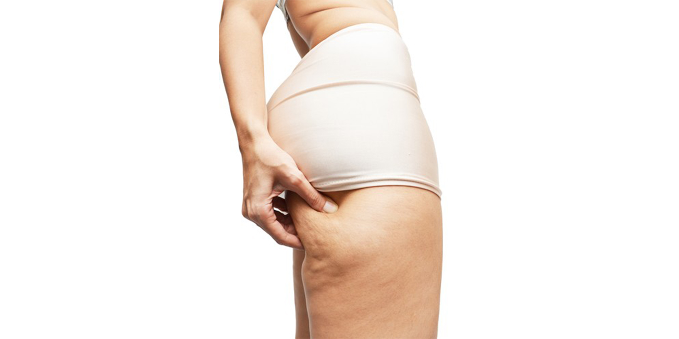 Cellulite Reduction